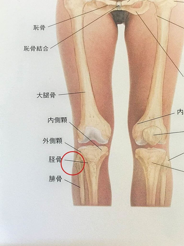 反張膝とアキレス腱痛 バレエ治療院あんじゅ