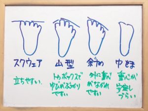 足の形の分類、バレエ・トウシューズのはきやすさとの関連、バレエ治療院あんじゅ